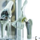 3D hip prosthesis