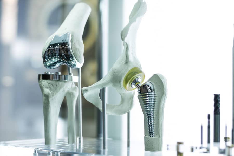 3D hip prosthesis